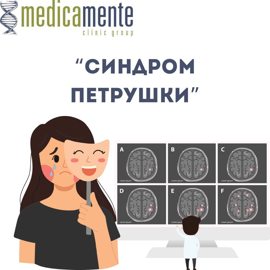 СМЕХ БЕЗ ПРИЧИНЫ